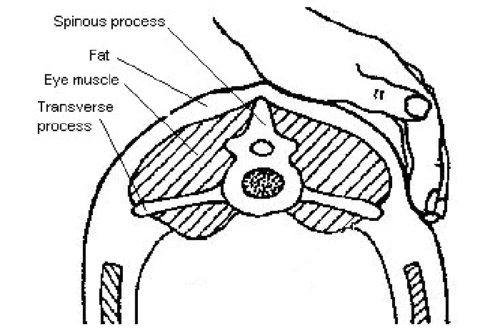 Feeling the tips of the spinous and transverse processes in the loin area