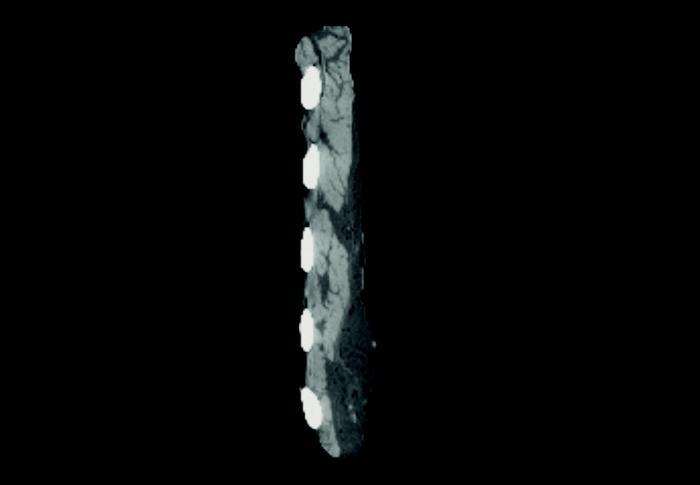 X-ray of beef rib from front profile