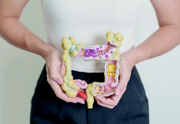 Person holding a model of intestines