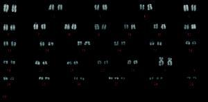 Detecting chromosomal abnormalities in cattle
