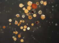 The soil microbiome and soil health