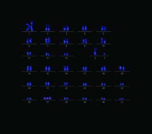 Karyotype-chromsome.