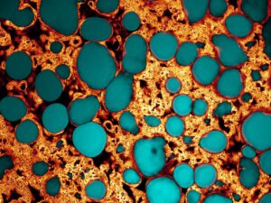 A micrograph of Irish Cheddar