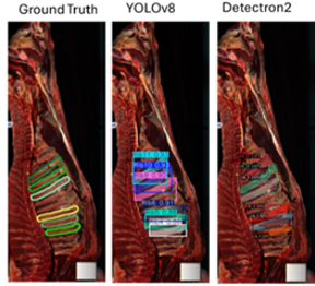 A set of three scans showing side views of a carcass with highlighted and labelled ribs in different colours. Each scan uses coloured outlines and numerical labels to mark specific ribs and regions.