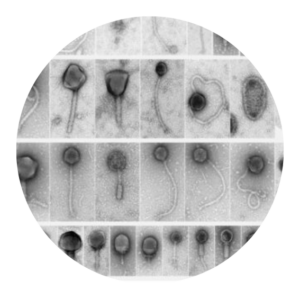 Microscopic image of rumen viruses