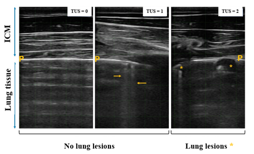 Ultrasonograms of the three thoracic ultrasound (TUS) score classifications. Echo of the lung tissue is observed in the bottom part, separated from the intercostal muscles (ICM) by the pleura (P). Normal healthy lung TUS=0. Two comet tails in TUS=1 are indicated with arrows. Lung lesions (1 cm2) in TUS=2 are marked with stars.